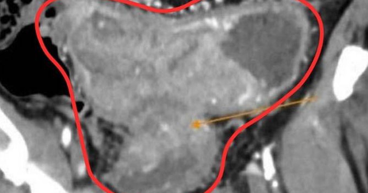 1Khoi U 17653369015121405299344 0 0 418 668 Crop 17653403888841277895498