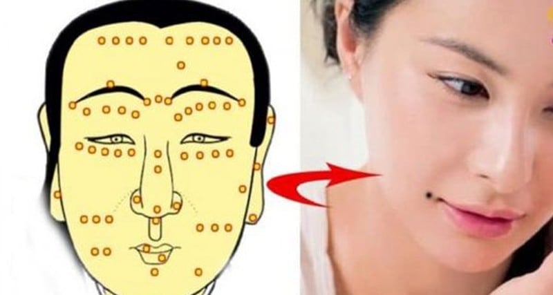 3 Not Ruoi Can Tro Tai Loc Lan Dan Tinh Duyen Ai Co Nen Tim Cach Hoa 122242