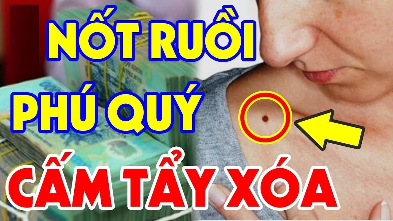 3 not ruoi may man dai phu dai quy ai co duoc dung dai xoa di 083636