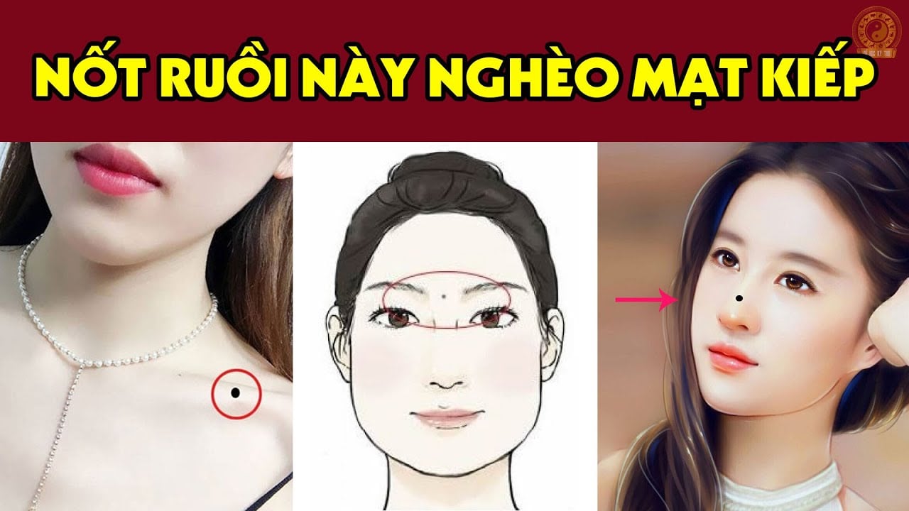 4 Not Ruoi Can Tro Tai Loc Lan Dan Tinh Duyen Co 1 4 Cung Nen Hoa Giai 113627