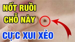 4 not ruoi hao tai nen hoa giai keo hao tai khanh kiet 203819