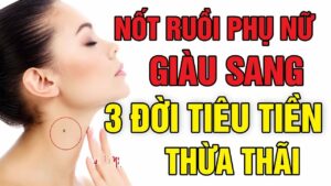 4 Vi Tri Not Ruoi Vang Muoi Giau Sang Huong Du So 1 Co Loc Ve Hau Van 094537