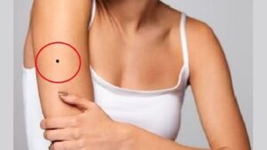 5 Vi Tri Not Ruoi Xau Tham Te Pha Duong Cong Danh Tinh Duyen Ban Can Tay Gap 000523