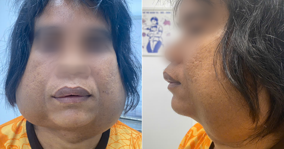 A X Song Cung 2 Khoi U Khong Lo Vung Mat Suot 10 Nam 17604988259051675582504 62 0 1402 2560 Crop 176