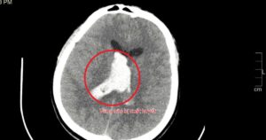 Anh 1 17629956049611444869764 43 0 1643 2560 Crop 1762995812176388143467