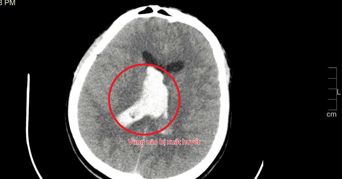 Anh 1 17629956049611444869764 43 0 1643 2560 Crop 1762995812176388143467