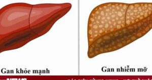 Avatar1764123460354 17641234606701740631156 0 38 315 542 Crop 1764123482811494853168