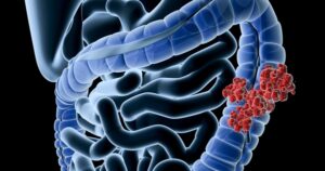 Avatar1765072875350 1765072875885503083359 36 0 664 1200 Crop 17650729515871197944533