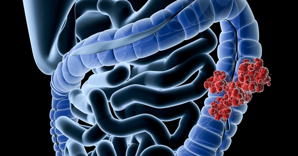 Avatar1765072875350 1765072875885503083359 36 0 664 1200 Crop 17650729515871197944533