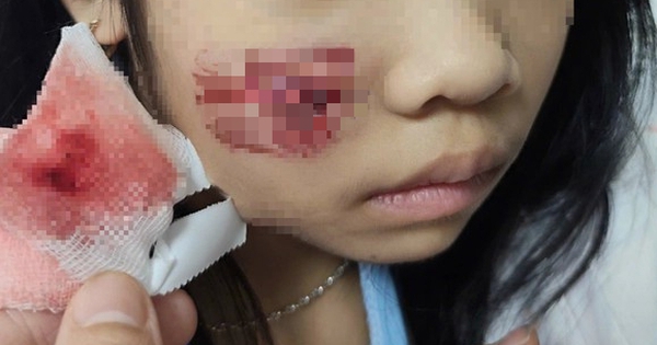 Avatar1765715914438 1765715915779745794961