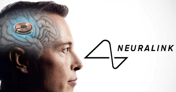 Avatar1765783924772 1765783926594660683928 0 0 1006 1920 Crop 17657839508402108880850