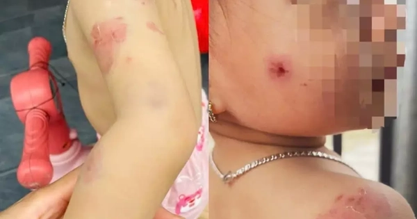 Avatar1765863815181 1765863815987511697634.Webp