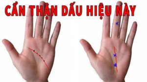 ban tay co 4 net tuong nay du tai ba toi may cung kho thoat ngheo 171115