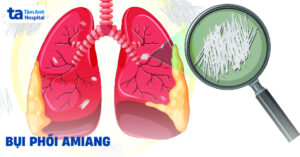bui phoi amiang