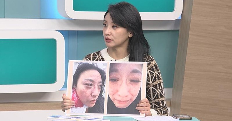 Ca Si Tam Van Bi Chong Kem 16 Tuoi Danh Den Ngat Xiu Doa Giet 3147