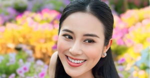 Ca Si To My Ra Sao Sau 4 Thang Nhap Vien Dieu Tri Phinh Dong Mach Nao 1486