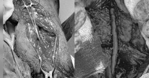 Fc23014Ae6Ec6Ab233Fd 17642336040862060246175 248 0 1848 2560 Crop 1764233913692506742054