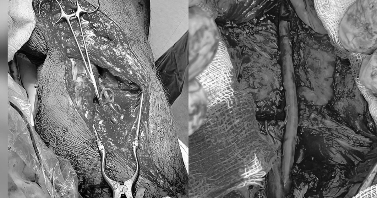 Fc23014Ae6Ec6Ab233Fd 17642336040862060246175 248 0 1848 2560 Crop 1764233913692506742054