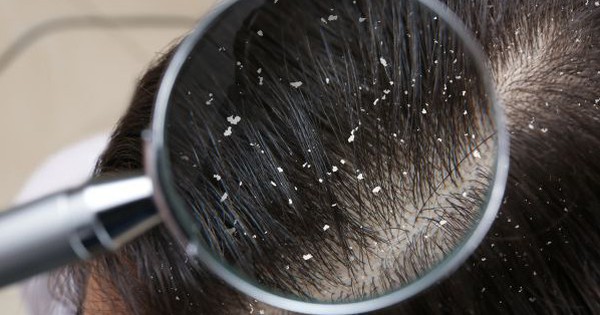 Gau Ong 3 1764426115650 17644261166261811658570 67 0 381 600 Crop 1764426151186620982014