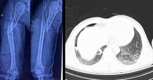 Ghep 17584285060592125354854 23 0 559 1024 Crop 17584286137521699713807