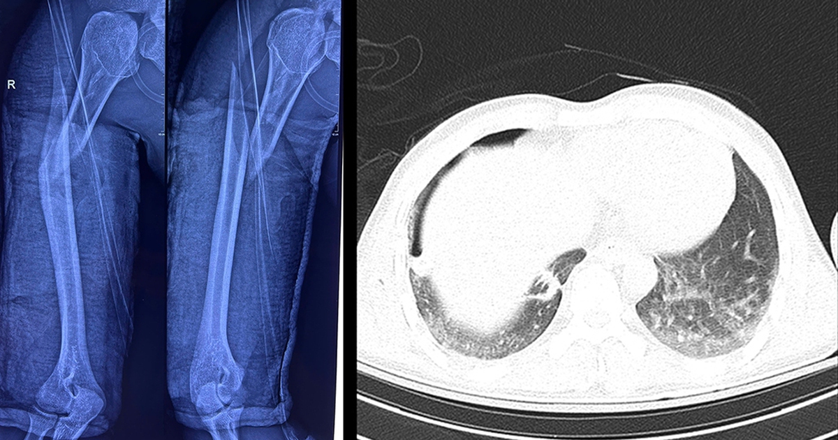 Ghep 17584285060592125354854 23 0 559 1024 Crop 17584286137521699713807