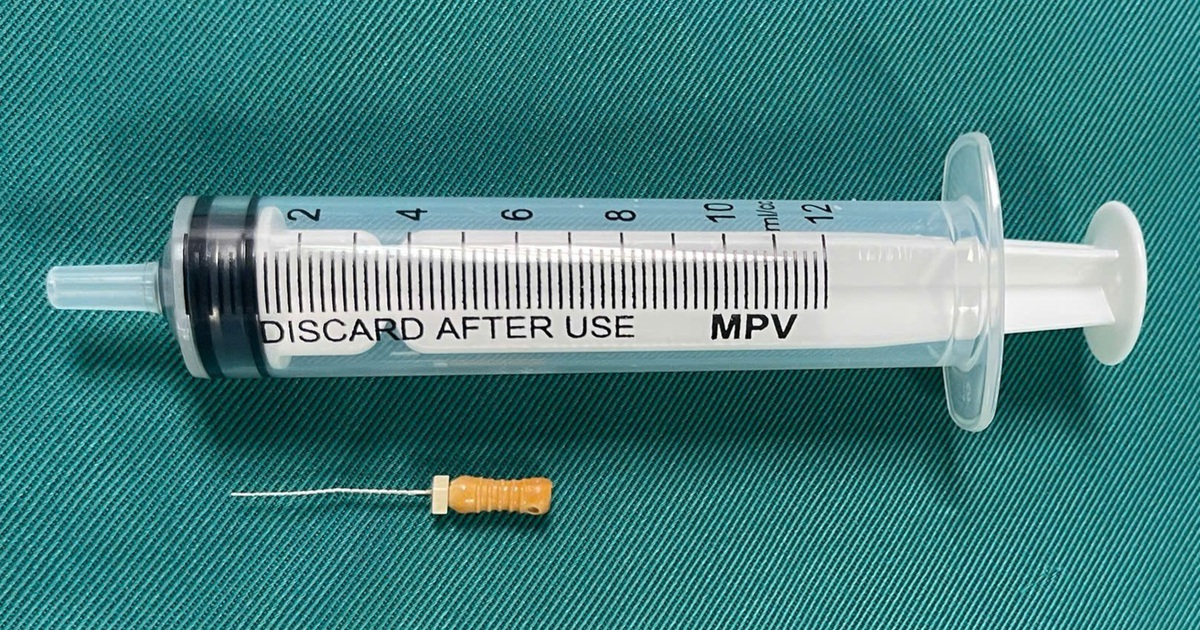 Img20251104190733 17631701382801262553553 207 0 1052 1613 Crop 1763170492698983967658