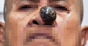 Khoi U 17637136188371024538098 0 0 1185 1896 Crop 1763713626059923496841