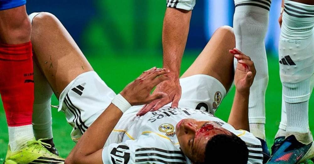mbappe do mau tren san real madrid tuc gian bi cuop phat den 458