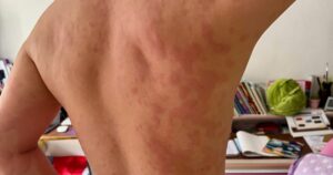 Me Day 1763612737714946168212 87 0 727 1024 Crop 1763613011020732993875