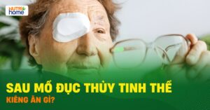 Mo Duc Thuy Tinh The Kieng An Gi 01