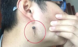 Moc Long O 4 Vi Tri Nay Tren Co The Cang Nhieu Thi Cang Phat Tai Phu Quy Tim Den Tai Loc Doi Dao 235