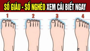 Nhin Tuong Chan Biet Tuong Lai Ban Thanh Phuong Hoang Hay No Ti Mai Mai 152440