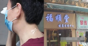 sau buoi ngam chan mien phi nguoi phu nu u60 ganh khoan no hon 600 trieu dong 526