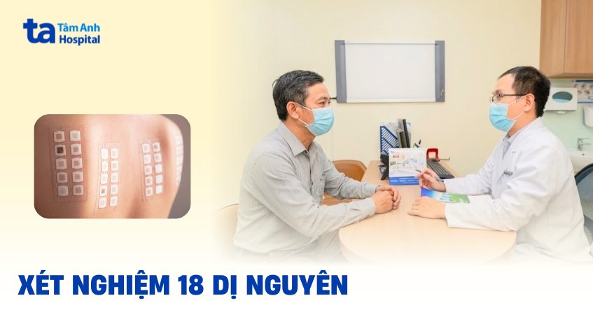 test ap bi 18 di nguyen