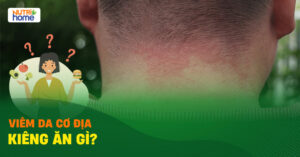 Viem Da Co Dia Kieng An Gi