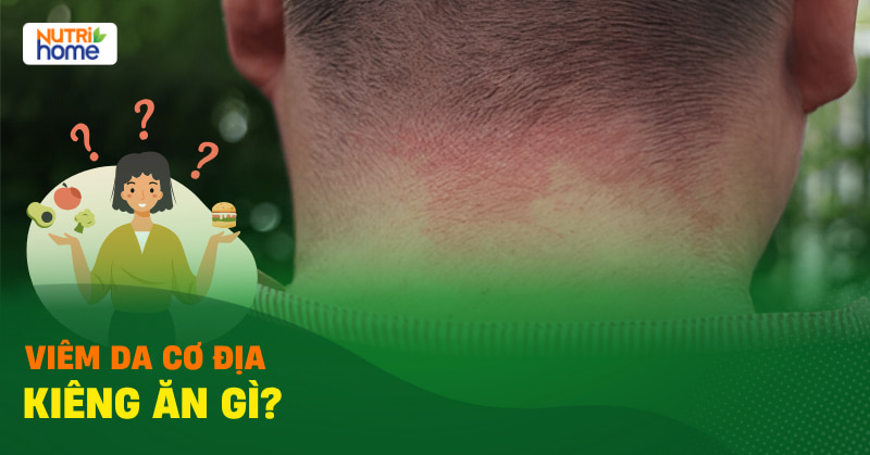 Viem Da Co Dia Kieng An Gi