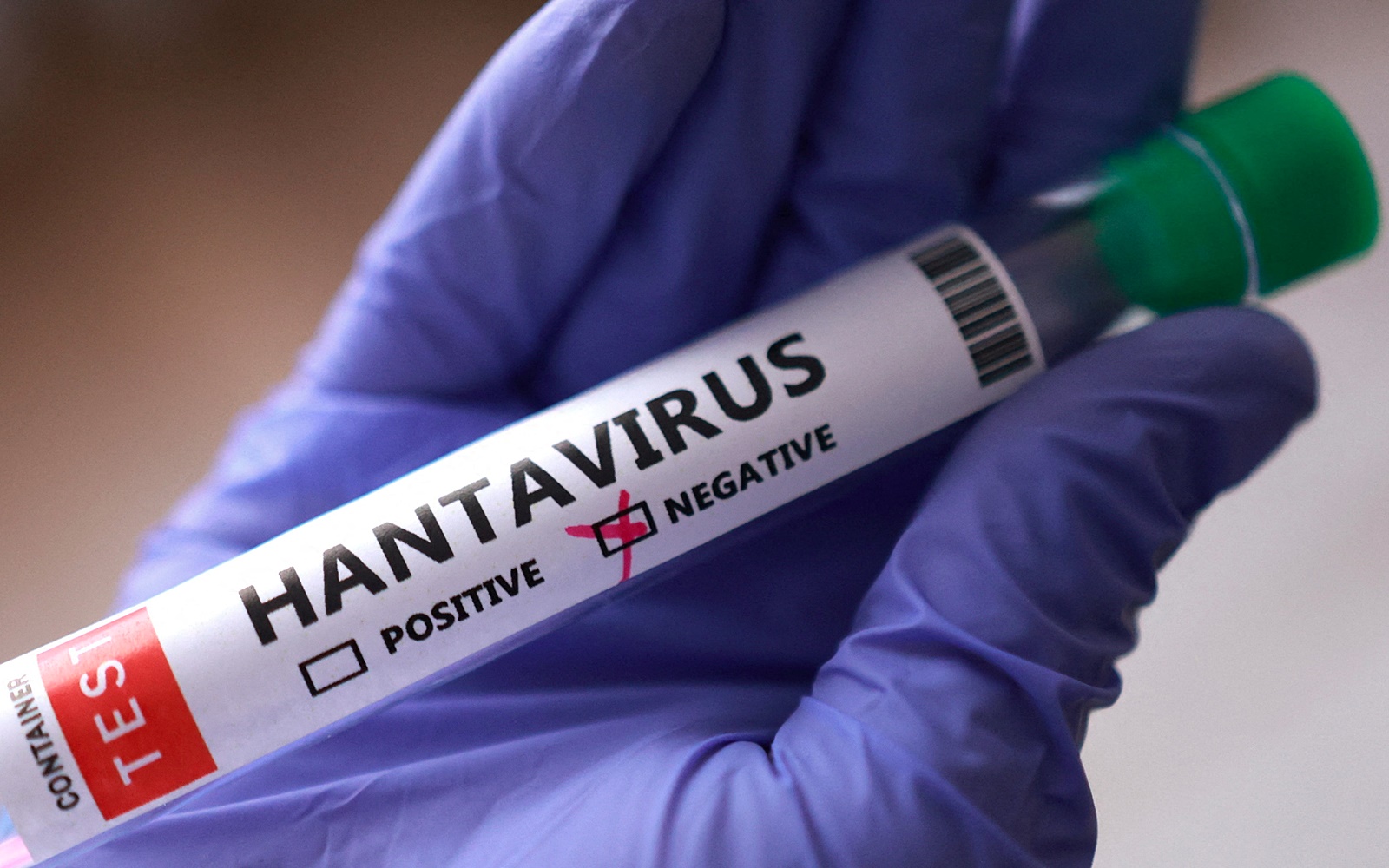 virus Hanta ong xet nghiem virus duong tinh am tinh reu