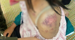 Vu Be Gai Bi Hanh Ha Da Man O Thai Nguyen Me Nan Nhan Ke Lai 4 Gio Kinh Hoang 688