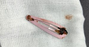 Z733384625021508C690Cafb26A82973077637Da570A75 17658919261561144176716 0 0 1080 1728 Crop 1765893520