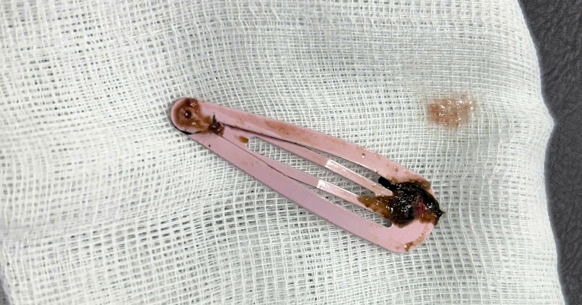 Z733384625021508C690Cafb26A82973077637Da570A75 17658919261561144176716 0 0 1080 1728 Crop 1765893520